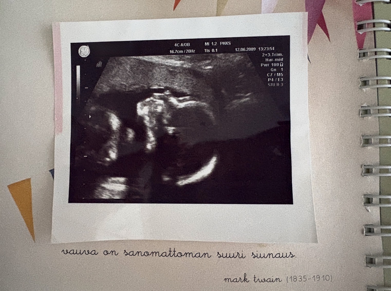Syntymättömän oikeuksista